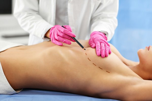 Comprendre la chirurgie seins : tout ce que vous devez savoir